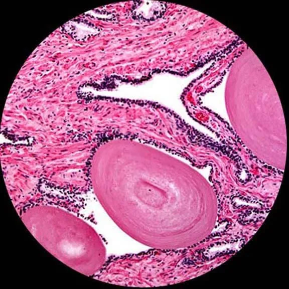 AmScope B120 Series Student & Professional LED Binocular Compound Microscope w/Siedentopf Head, 3D Mechanical Stage & Optional Digital Camera